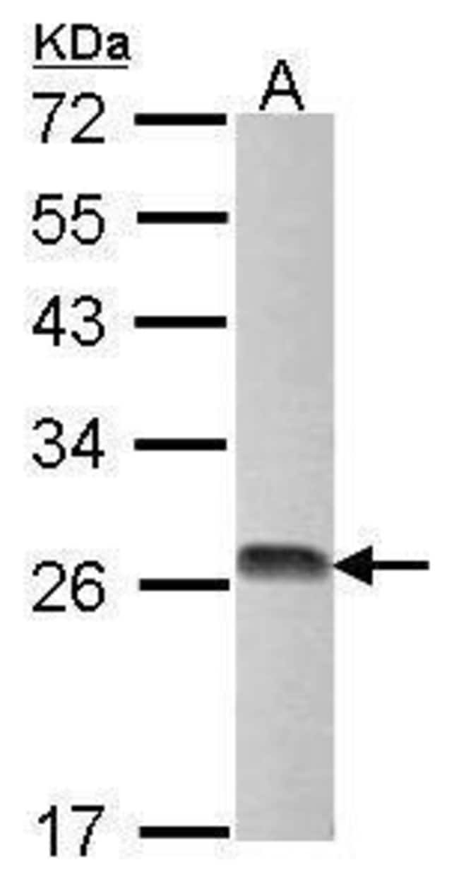 Anti-Thymidylate kinase
