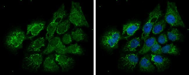 100ul ECHS1 Polyclonal Antibody