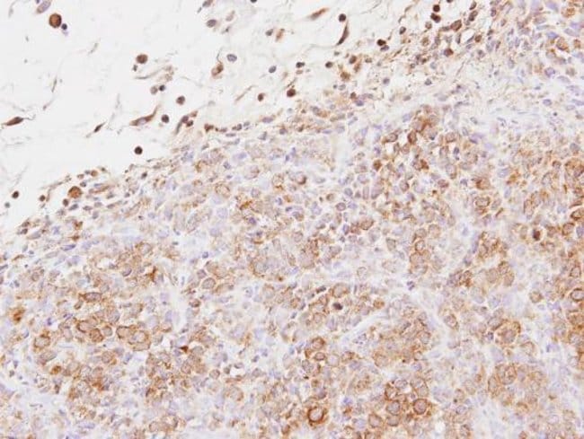 Anti-Exostosin-like 2
