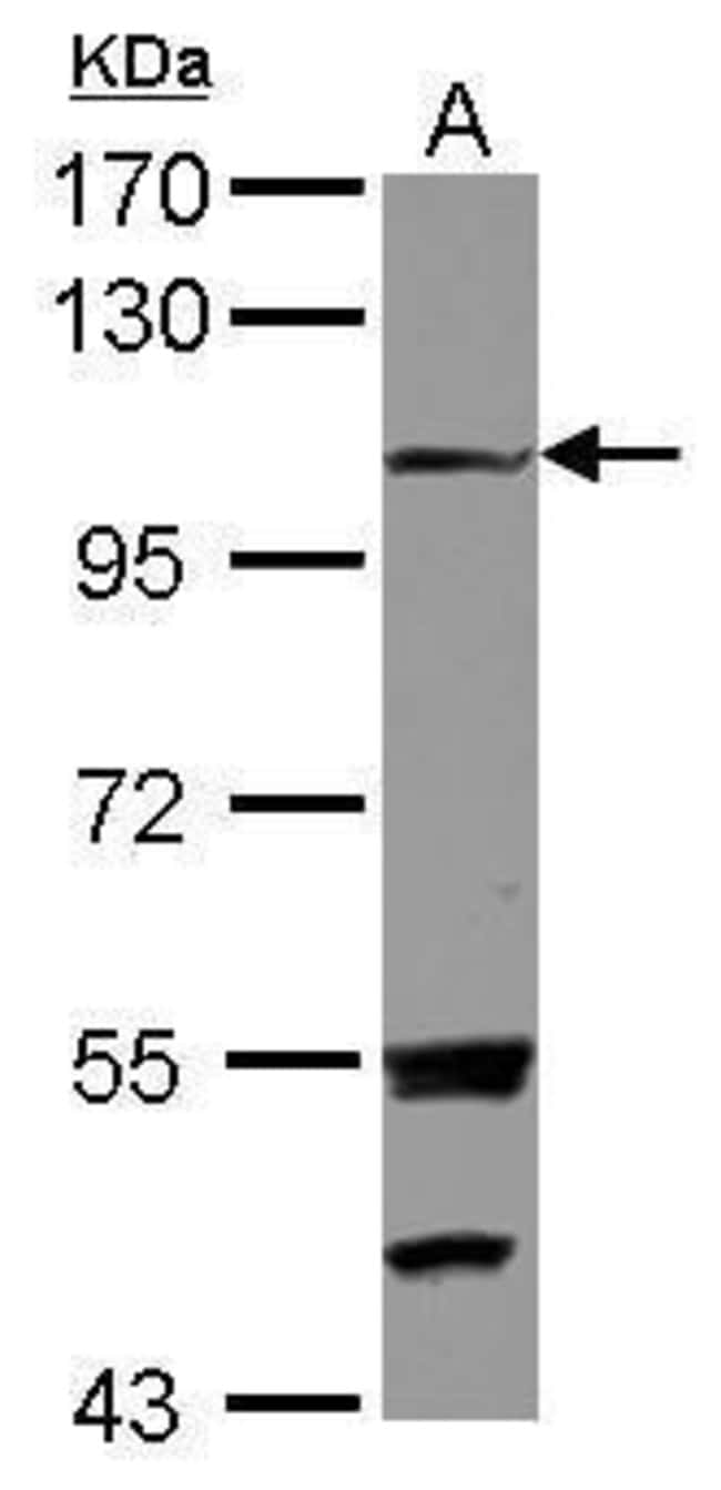 Anti-EXTL3