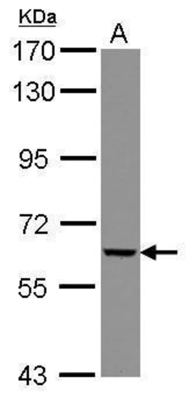 Anti-GGT5