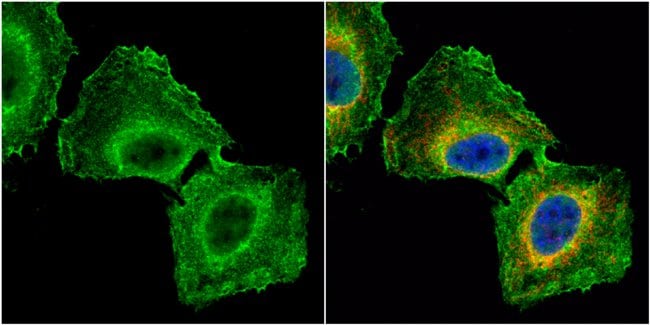 100uL Polyclonal antibody, GNB1, host ra