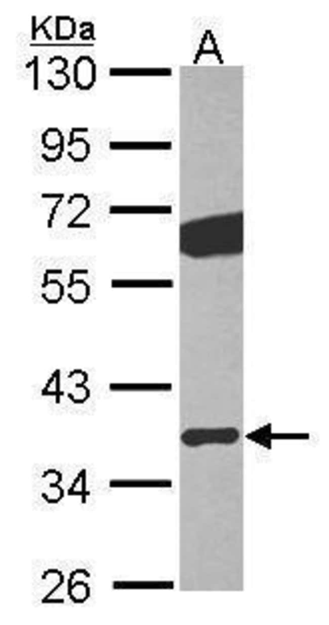 Anti-GNB2
