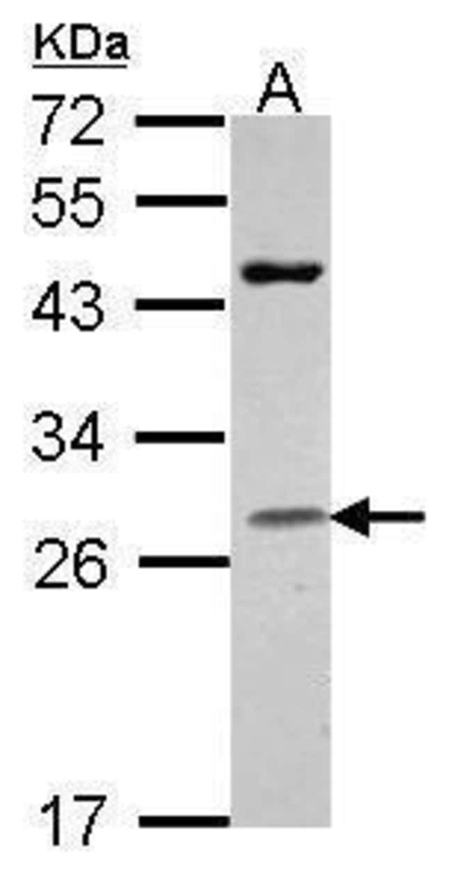 Anti-Granzyme H