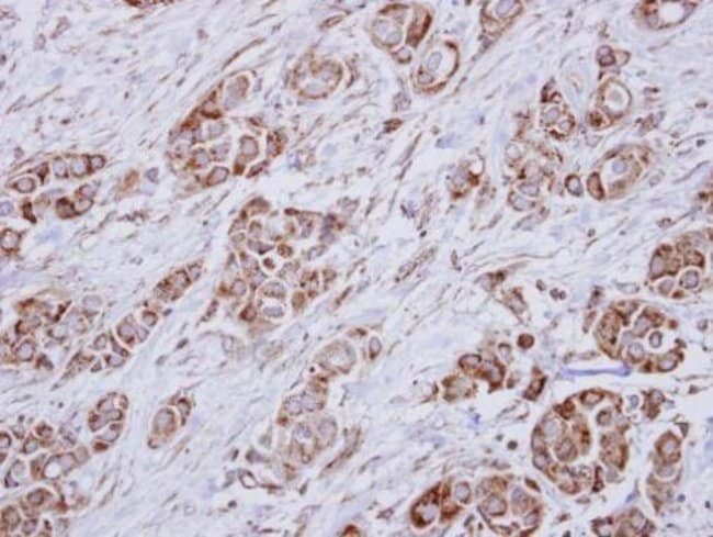 Anti-HMGCL