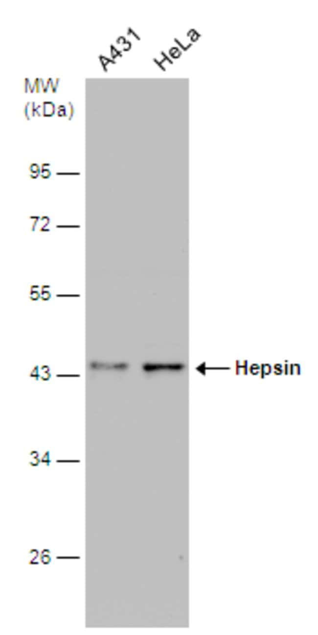 Anti-Hepsin
