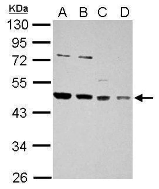 Anti-HDJ2
