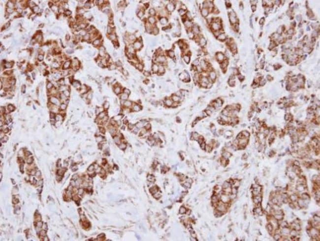 Anti-IDH3A