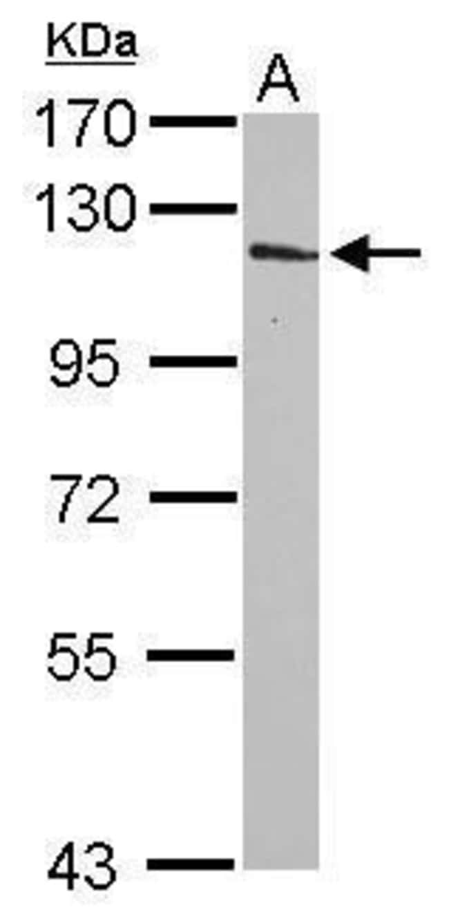 Anti-INPP4A
