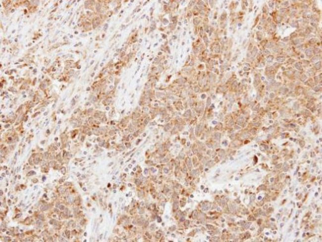 Anti-Lipocalin 1
