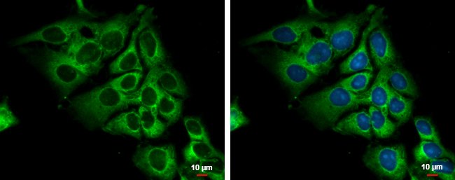 Anti-lactate dehydrogenase C