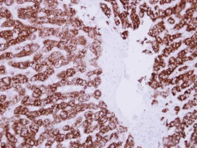 Anti-ALDH6A1