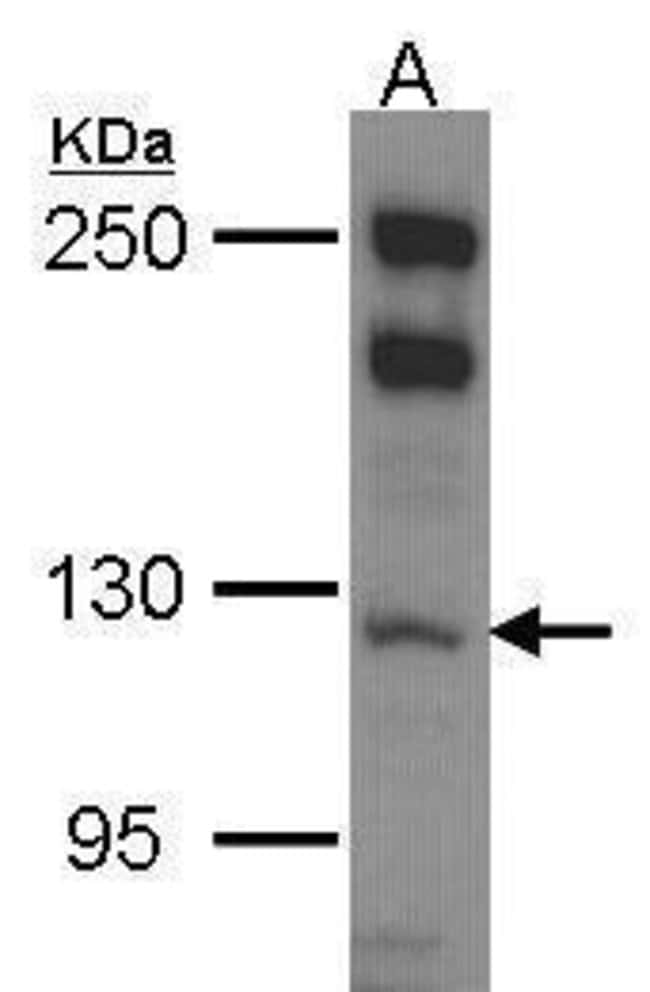 Anti-MYO1B