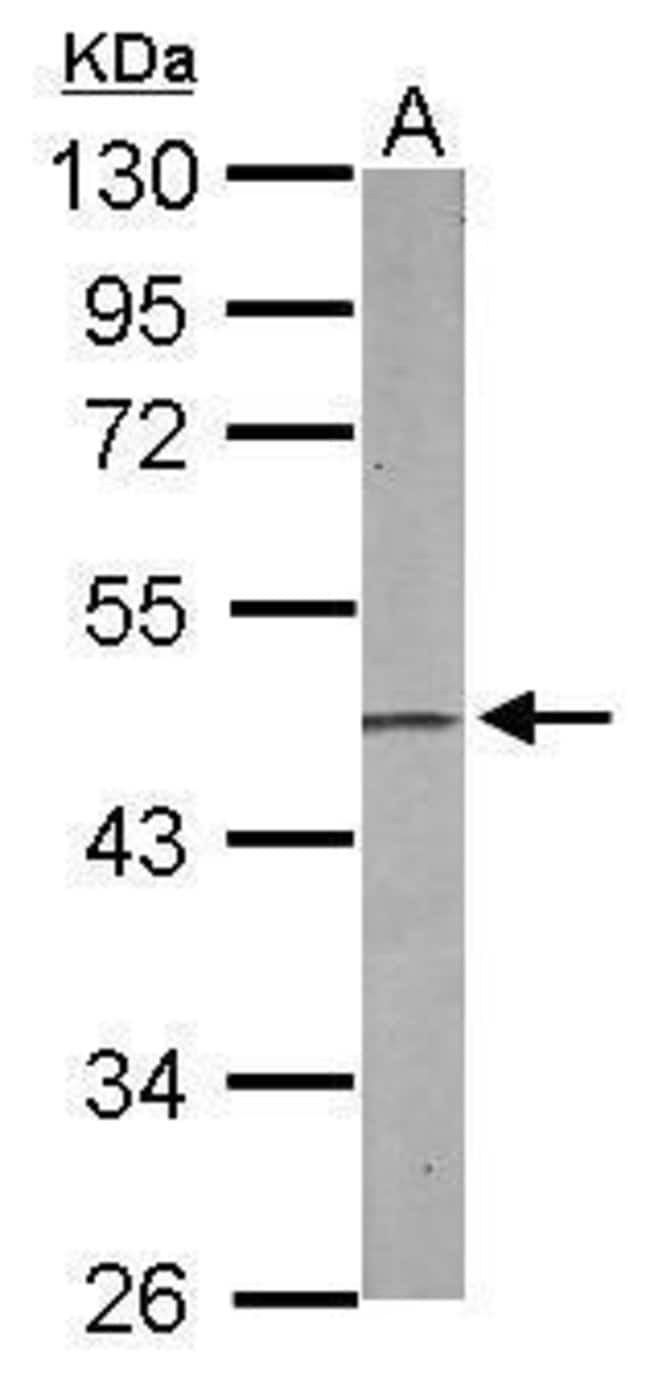 Anti-EBP1