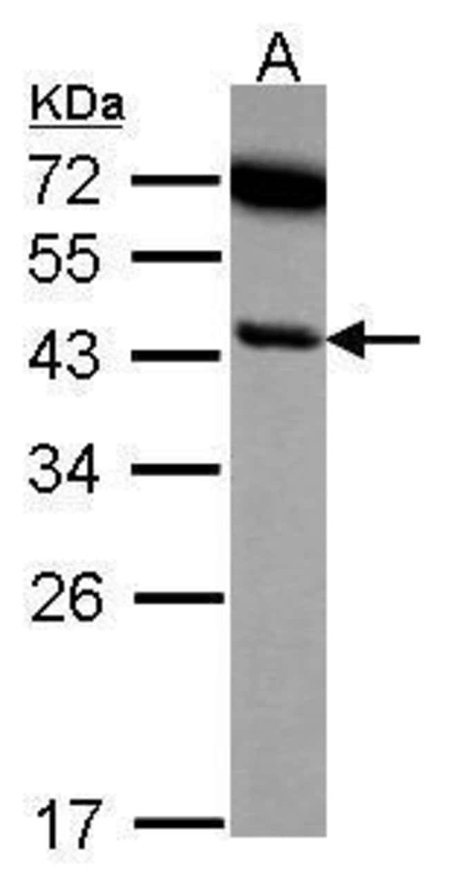 Anti-SERPINB6