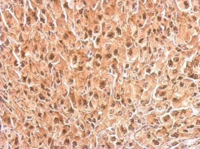 Anti-PSMC4