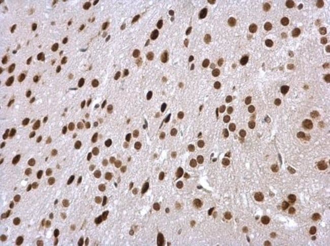 Anti-PSMC5
