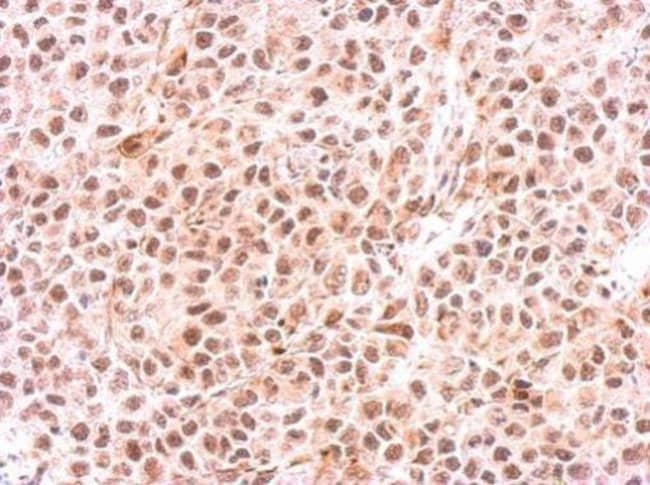 Anti-PSMC6