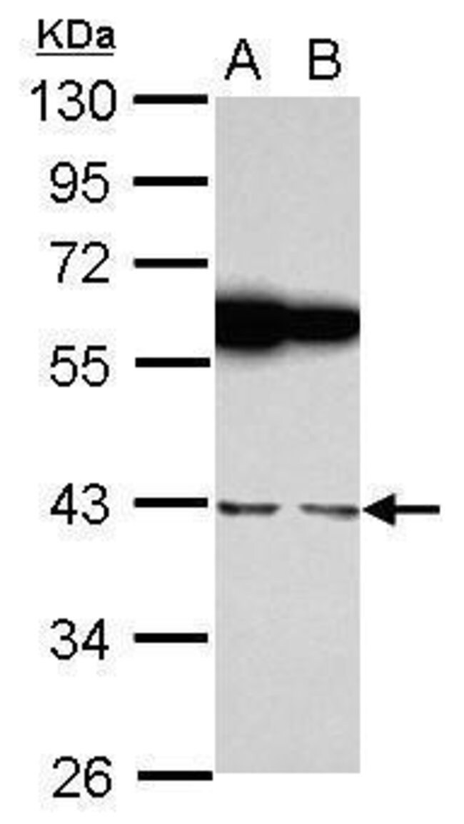 Anti-RBMS1