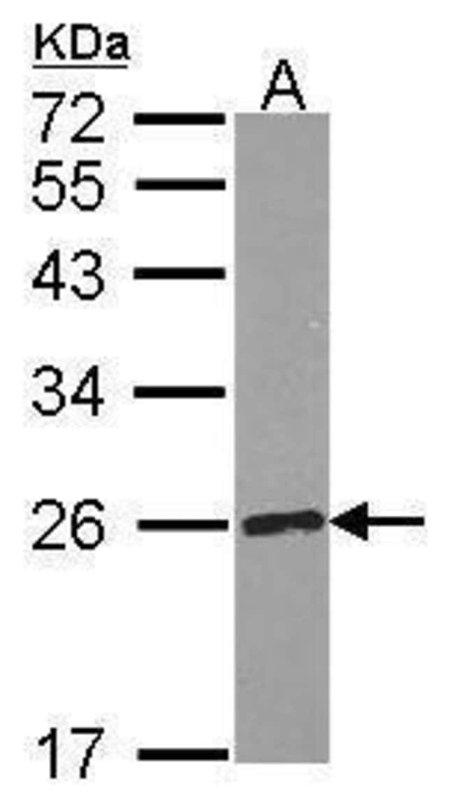 Anti-RPE