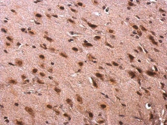 Anti-TRA2B