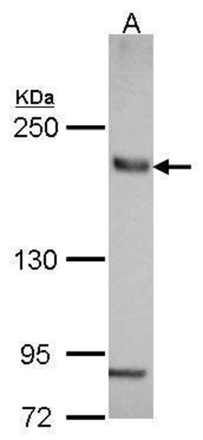 Anti-SLC4A2