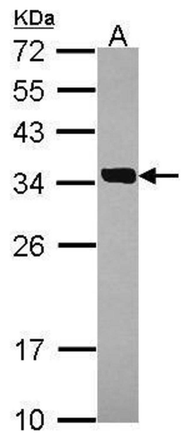 Anti-SULT2A1
