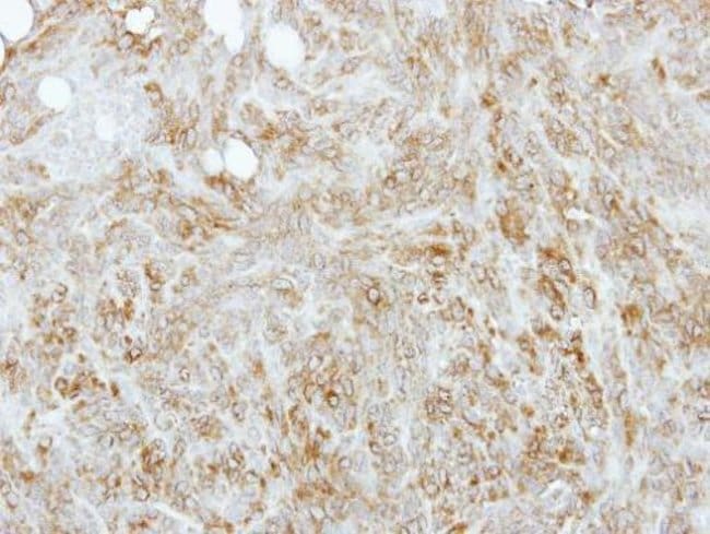 Anti-Tropomyosin 4