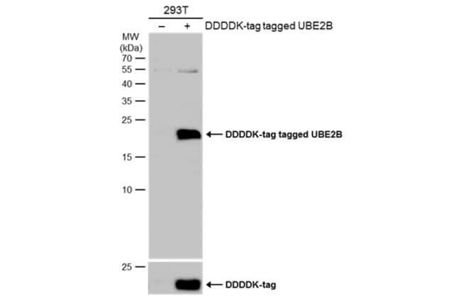 Anti-UBE2B
