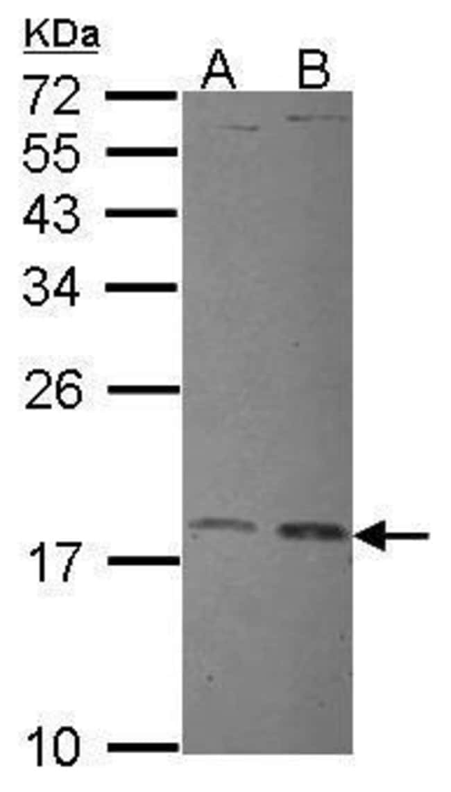Anti-UBE2L3