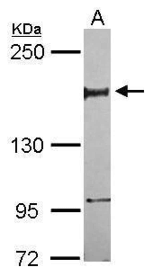 Anti-NFRKB