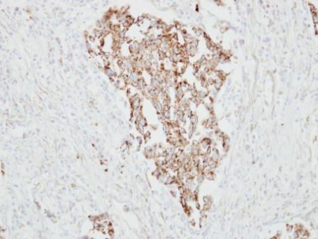 Anti-TIG1