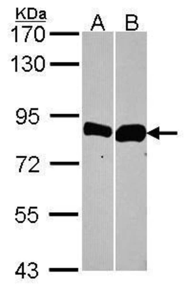 Anti-Thimet Oligopeptidase