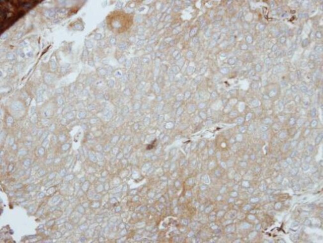 Anti-LIMS1