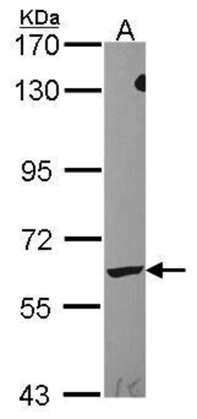 Anti-Leukotriene A4 hydrolase