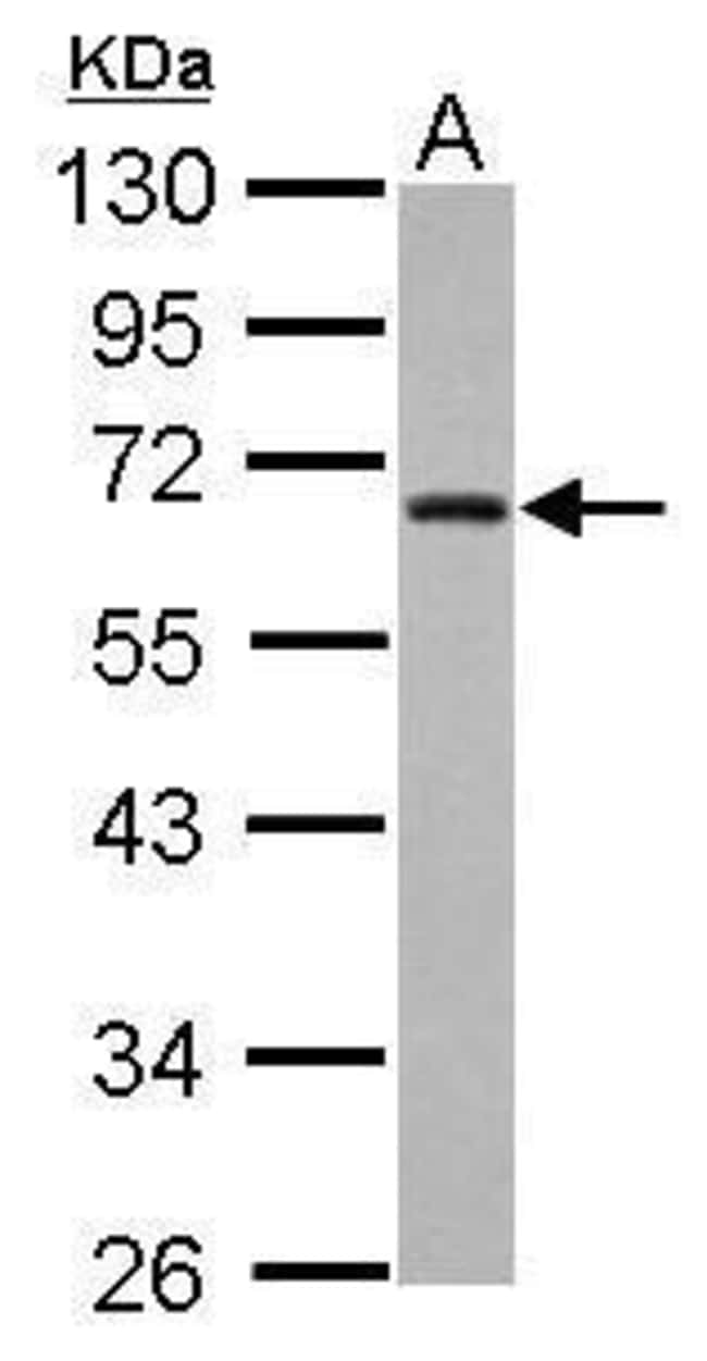 Anti-ZNF215