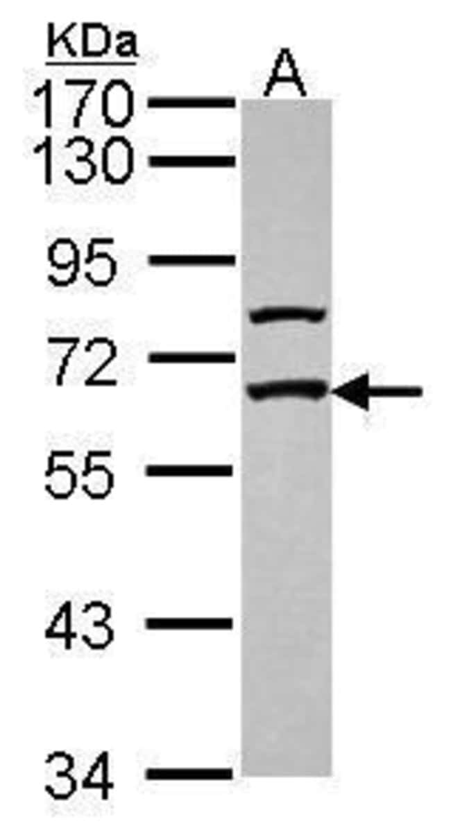 Anti-GABA Receptor Epsilon