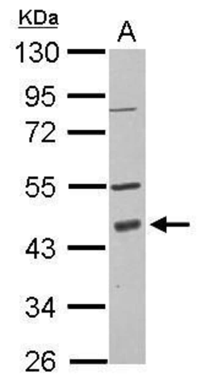 Anti-PDCD2