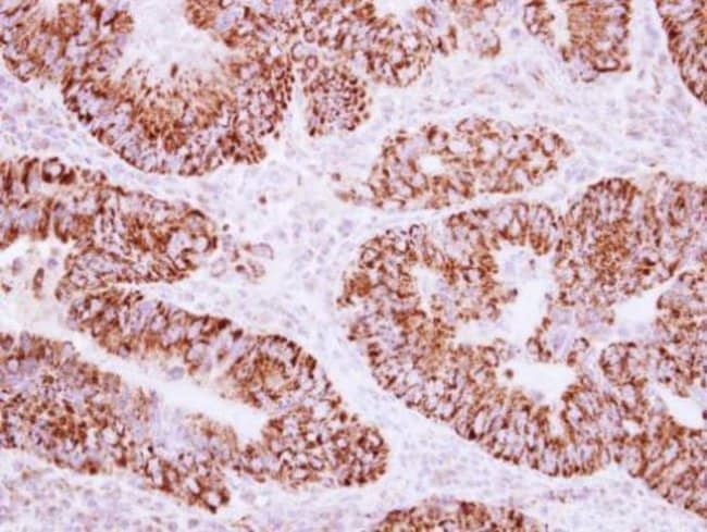 Anti-AKAP1