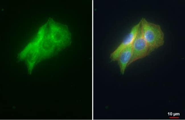 Anti-VDP/p115