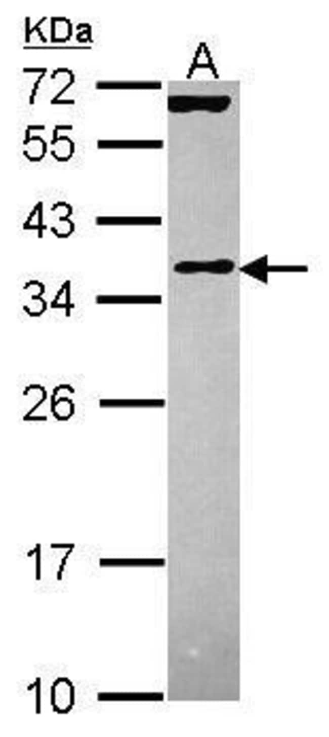 Anti-EIF3J