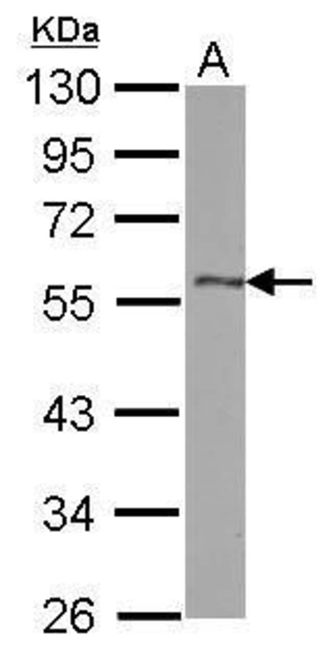 Anti-DLK1