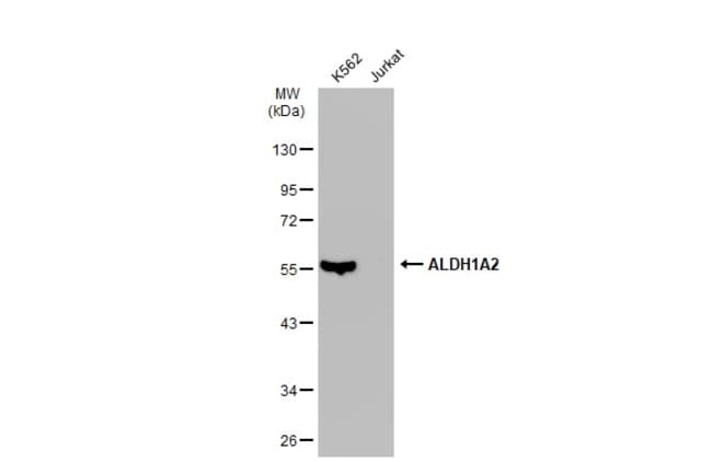 Anti-ALDH1A2