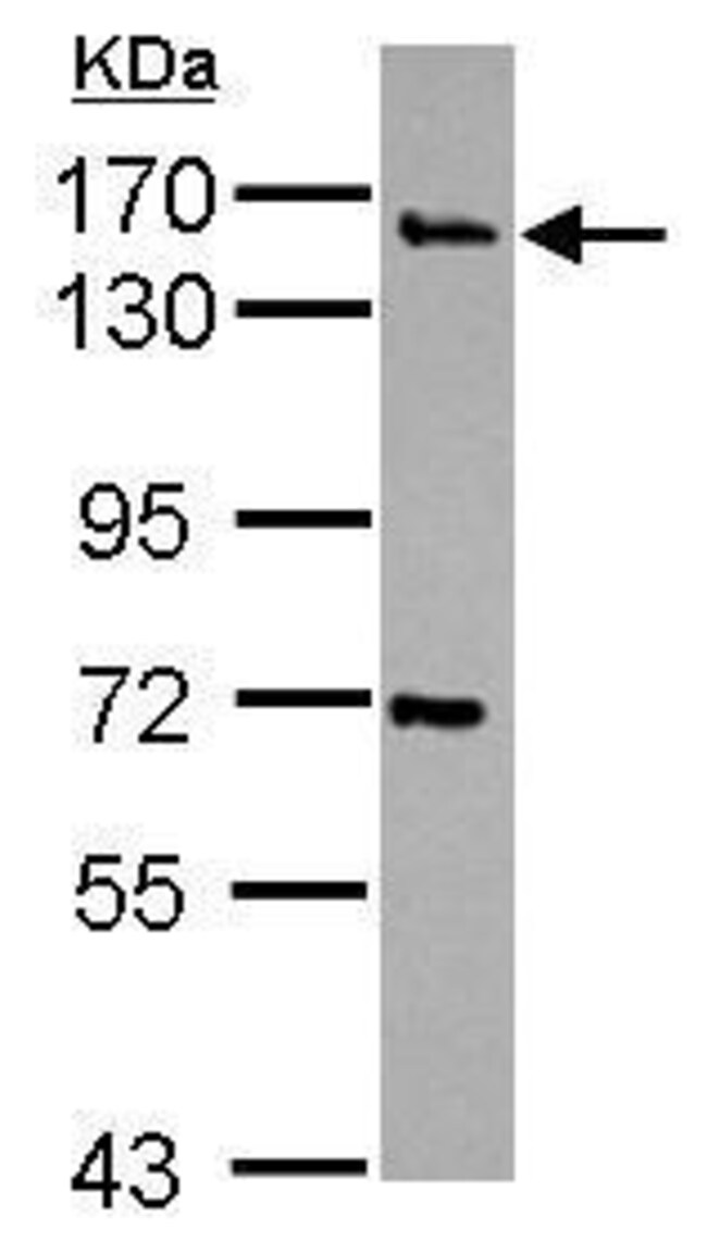 Anti-Synaptojanin 2