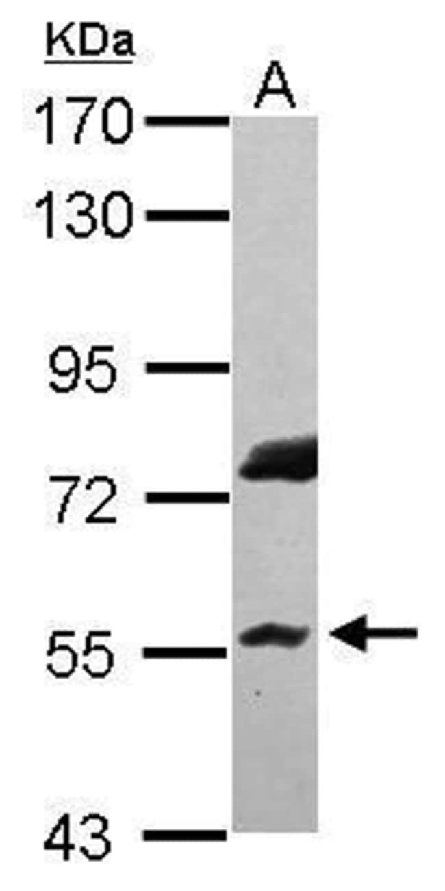 Anti-RNF8
