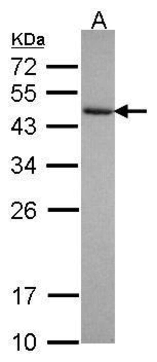 Anti-GRP1