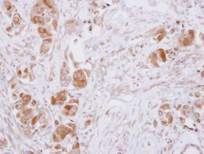 Anti-Guanine deaminase