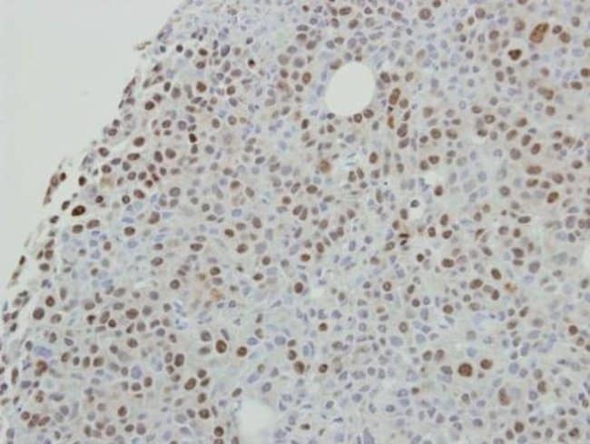 ANTI-SCAFFOLD ATTACHMENT FACTOR B2