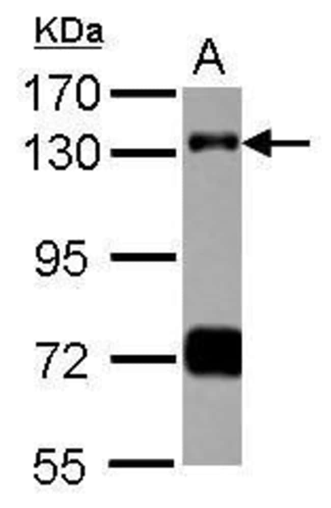 Anti-RNF40