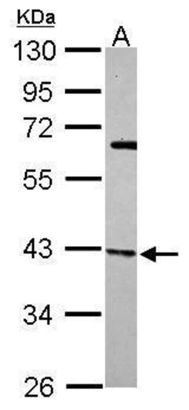 Anti-p41-ARCb